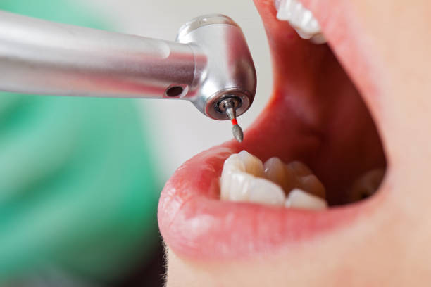 Best Emergency Dental Care for Sports Injuries in Thornport, OH